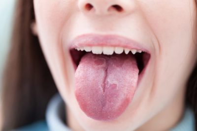 Dry Mouth Causes