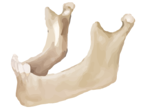 Bone-graft-in-Wayne-County-MI-222 Bone-graft-in-Wayne-County-MI-222