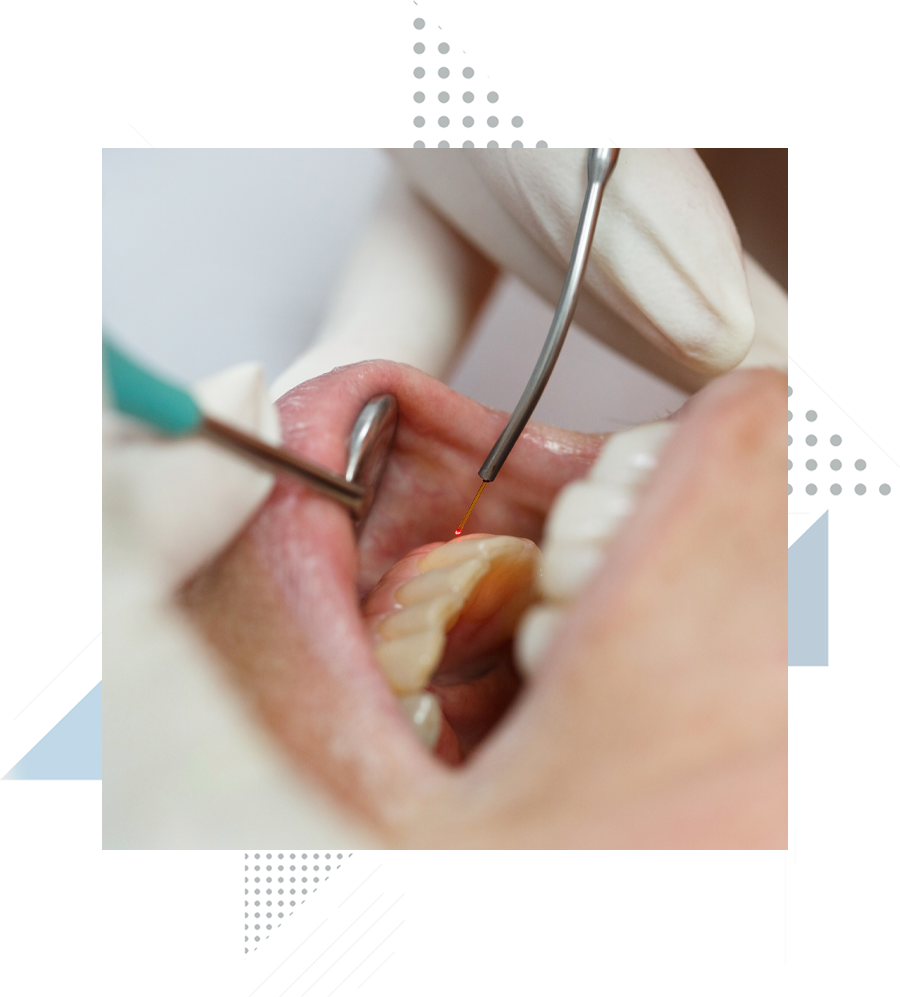 dental-patient-undergoing-lanap-treatment