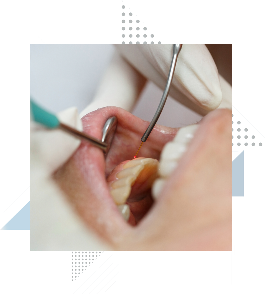 dental-patient-undergoing-lanap-treatment dental-patient-undergoing-lanap-treatment