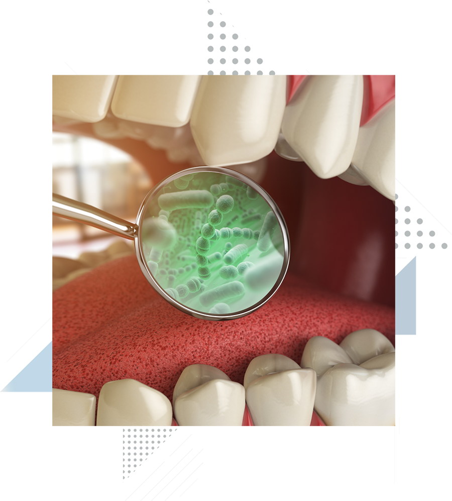 gum-disease-graphic-1