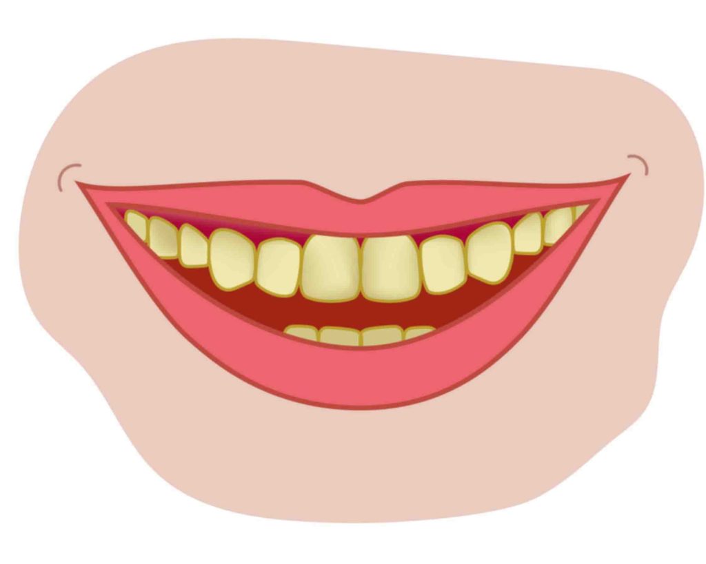 yellow teeth, mouth